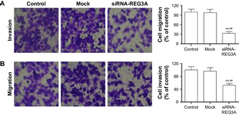 Reg3a Knockdown Suppressed The Migration And Invasion Of Gc Cells