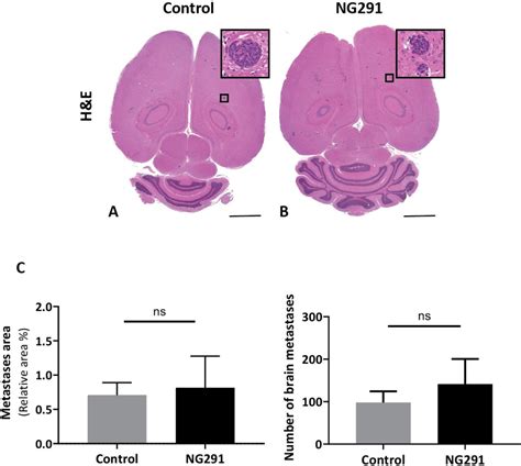 Table 1 From Pharmacological Modulation Of Bloodbrain Barrier