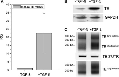 Poly A Tail Shortening Correlates With Mrna Repression In Tropoelastin