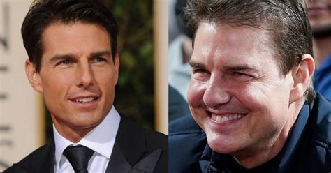 O que aconteceu o rosto de Tom Cruise Os fãs estão preocupados