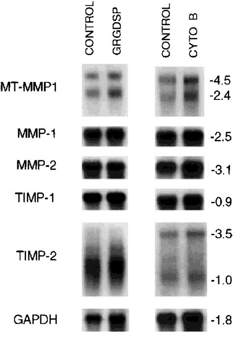 Representative Northern Blots Demonstrating MRNA Levels For MTMMP 1