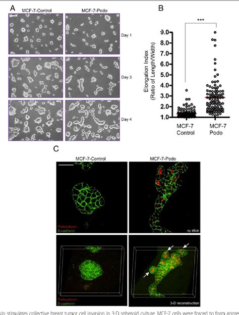 The Cell Surface Mucin Podocalyxin Regulates Collective Breast Tumor