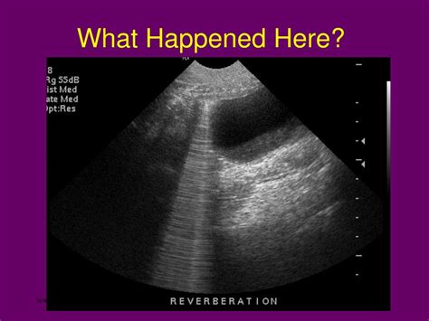 Ppt Ultrasonography Powerpoint Presentation Free Download Id623027