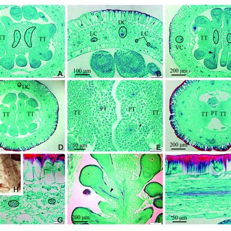 The Flower And Pistil Of Dianthus Chinensis L Cb Connecting Bands Download Scientific