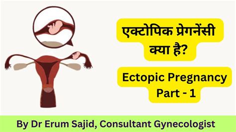 Ectopic Pregnancy Causes Signs Symptoms Treatment Dr Erum Hassan