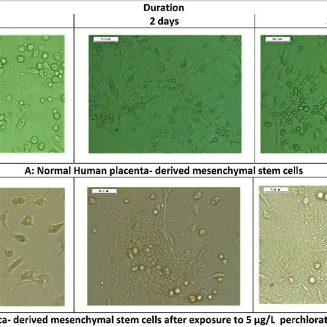 Photomicrographs Of Normal Human Placenta Derived Mesenchymal Stem