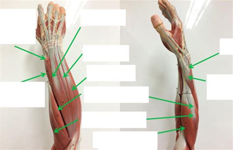 Muscles That Move The Hand And Digits Extensors Diagram Quizlet