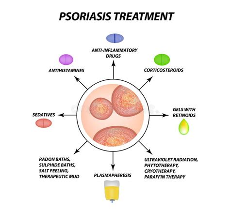 Psoriasis Treatment Eczema Dermatitis Skin Disease Psoriasis Infographics Stock Vector