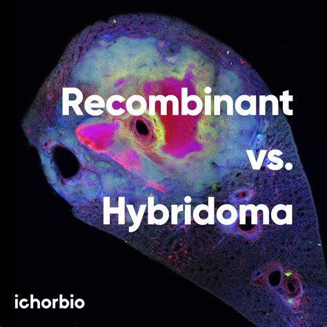 Western Blot Standard Protocol - ichorbio