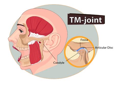 Why TMJ Noise Is Important Cosmetic Dentistry Dr Henry