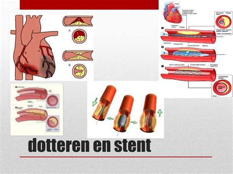 Ppt De Bloedvaten Powerpoint Presentation Free Download Id2314890