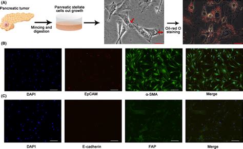 Isolation And Identification Of Human Pancreatic Stellate Cells Pscs