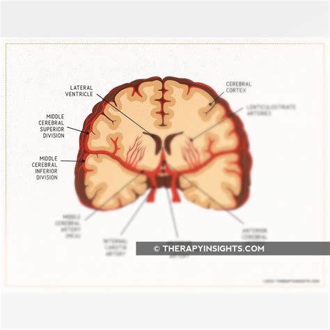 The Blood Vessels in the Brain – Adult and pediatric printable ...