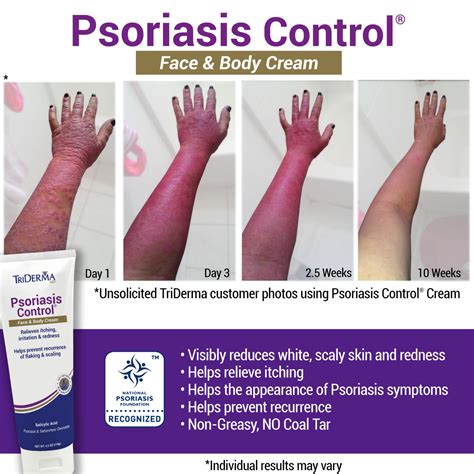 Psoriasis Control Face & Body Cream by TriDerma | Soothe and Relieve