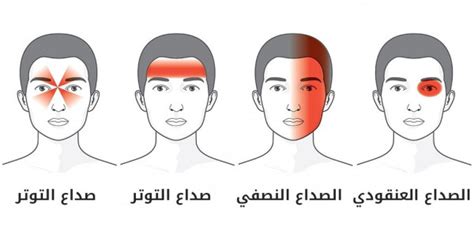 أقوى انواع الصداع وطرق الوقاية منه بسيط دوت كوم