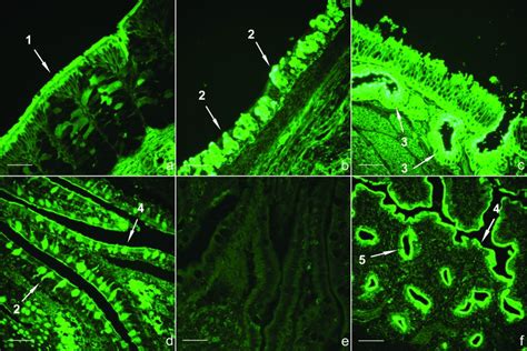 Lectin Binding Of Sna For Linked Sa Receptors In The Respiratory