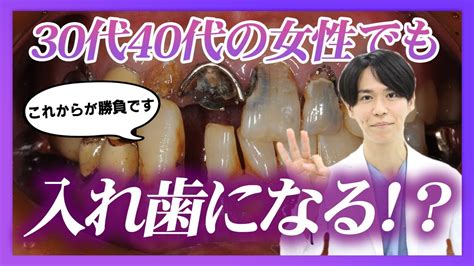 【女性の方必見】30代40代の女性が入れ歯を回避するためには！？ Youtube