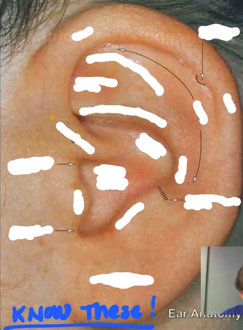 Auricular Acupuncture Diagram Quizlet