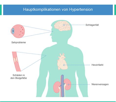 Bluthochdruck Behandlung Rezeptfrei Online