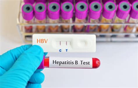 Hbsag Tes Darag Untuk Memastikan Hepatitis B Doktersehat