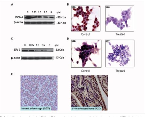 Figure From Estrogen Receptor As A Potential Target For Colon