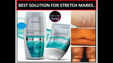 Best Solution For Stretch Marks Optimals Body Firming Lotion Youtube