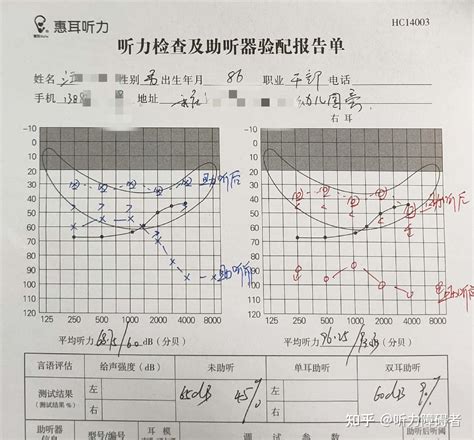 重庆渝北助听器：关于老年性耳聋的案例分享 知乎