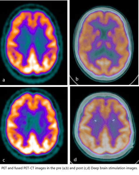 Pet Brain Scan