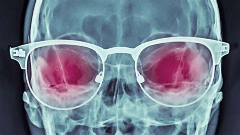 The Secret History Of X Ray Specs Bbc Future