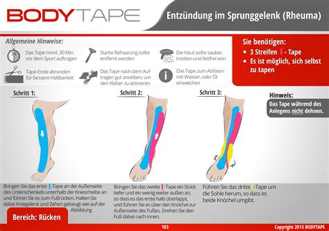 Cool B Nderriss Im Sprunggelenk Erfahrungsberichte