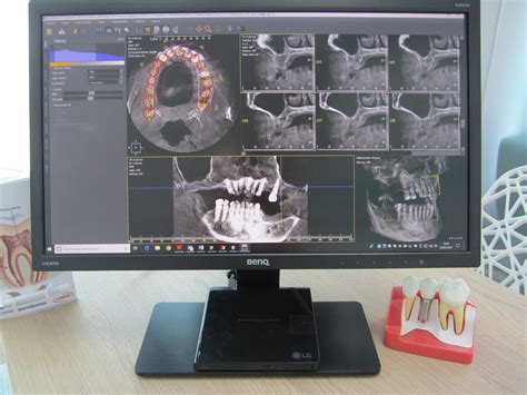 Radiodiagnostico - DentalFuenteNueva San Pedro Alcántara - San Pedro