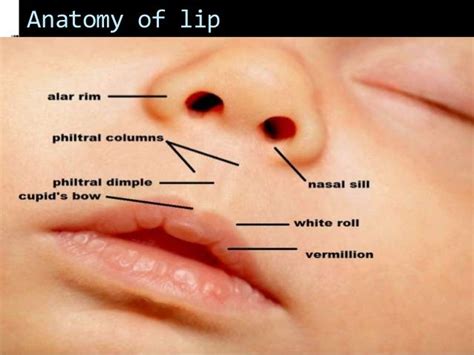 Cleft Lip And Cleft Palate Embryology Features And Management