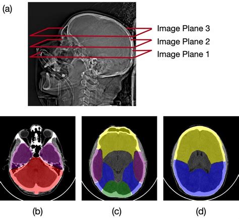 Examples Of Annotated Anatomical Regions A Lateral View Of The Skull