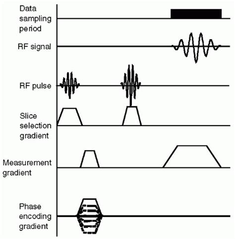 Spin Echo Radiology Key