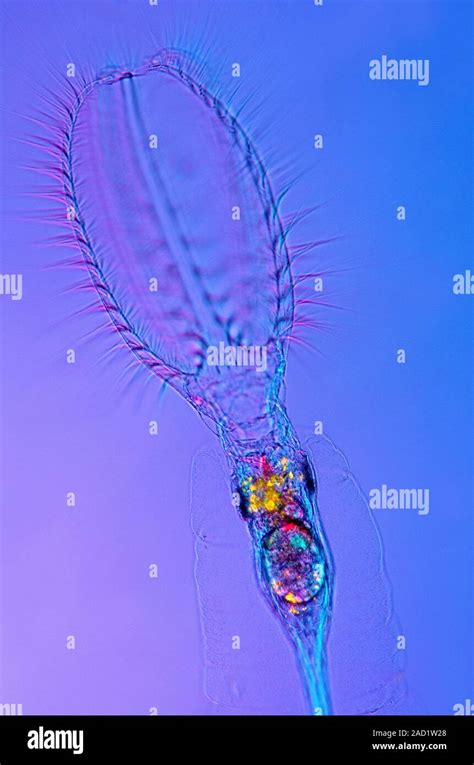 Stephanoceros Rotifer Polarised Light Micrograph Of A Stephanoceros