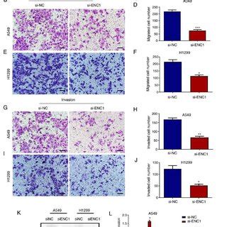 Upregulation Of ENC1 Enhances The Proliferation Migration And Invasion