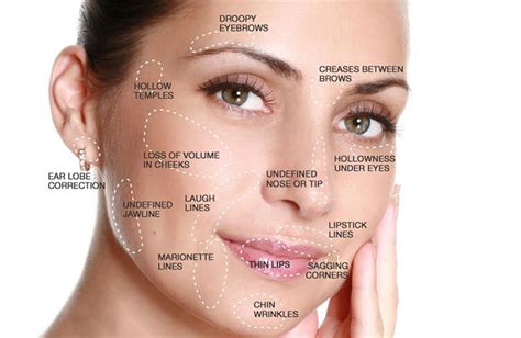 Dermal Fillers — Rejuvenation