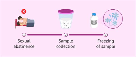 The sperm donation process