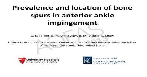 Prevalence And Location Of Bone Spurs In Anterior Ankle Impingement