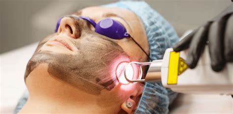 Laser Skin Treatments In India Benefits Cost And Side Effects