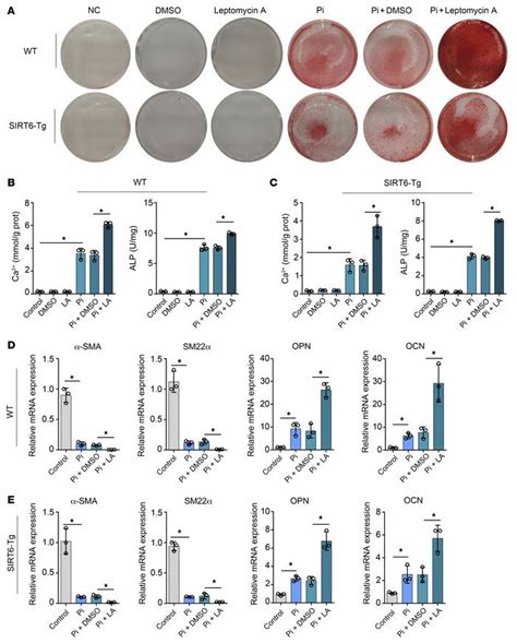 JCI SIRT6 Protects Vascular Smooth Muscle Cells From Osteogenic