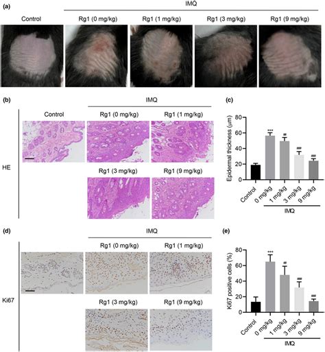 Ginsenoside Rg Inhibits Imqinduced Pathology And Proliferation In