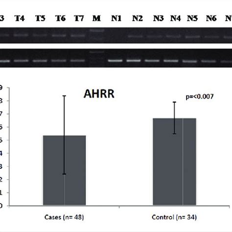 A MRNA Expression Pattern Of AHRR Gene In Gallbladder Cancer And