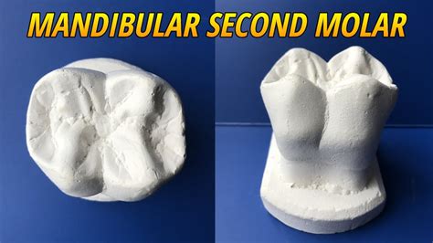 Carving Of Mandibular Second Molar Tooth Morphology Youtube