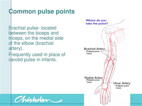 Pulses In Body Diagram At Yesenia Glass Blog