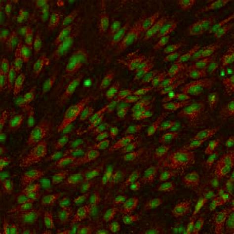 Human Brain Microvascular Endothelial Cells Innoprot Brain Cell System