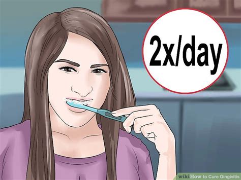 3 Ways to Cure Gingivitis - wikiHow Health