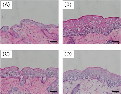 Hematoxylin And Eosin Staining And Thickness Of Epidermis In Mouse