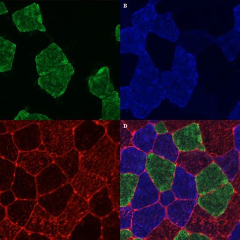 Muscle Fiber Typing With Myosin Heavy Chain Staining Method A Type I