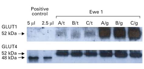 Western Blotting Showing The Glucose Transporters 1 And 4 Glut1 And